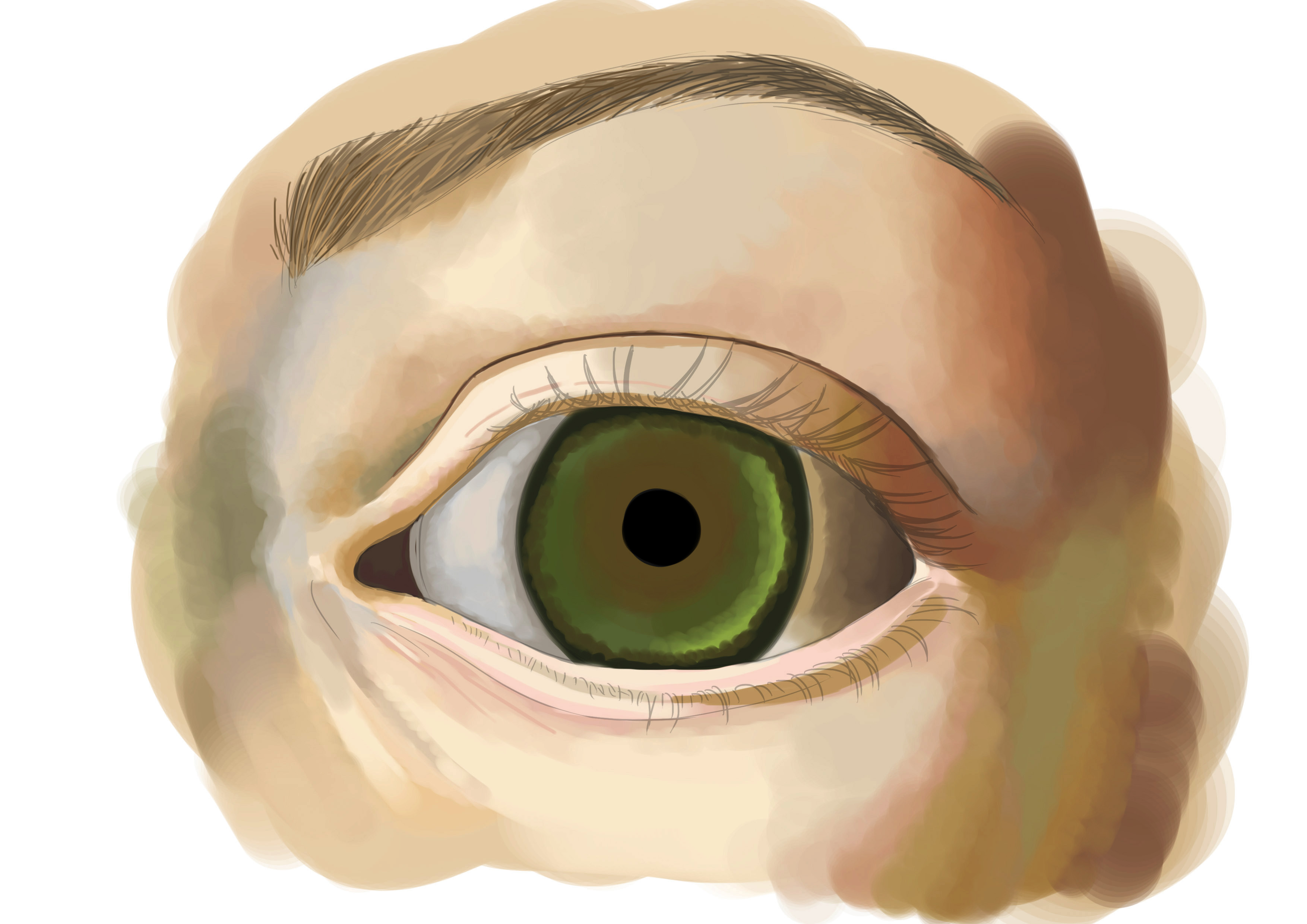 Dessin incorrecte de la pupille de l'oeil